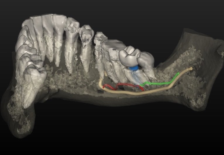 impianti dentali: ricostruzione anatomica