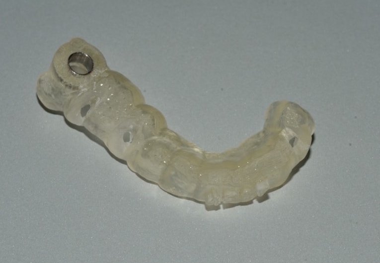 impianti dentali: guida chirurgica